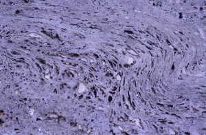 texture-stone-ni3v